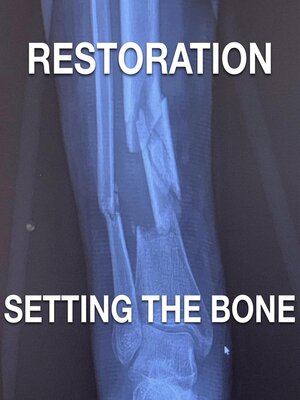 cover image of Restoration--Setting the Bone